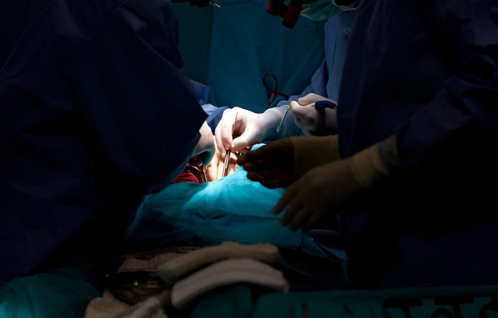 doctors performing heart surgery